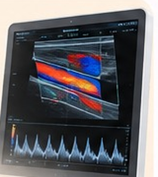 Monitor de ultrassom com Doppler colorido